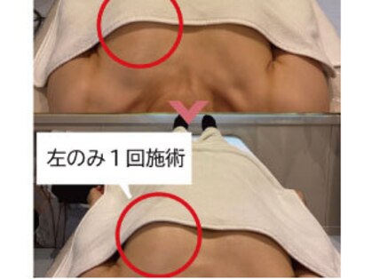 ブエナイン(Buenaine)の写真