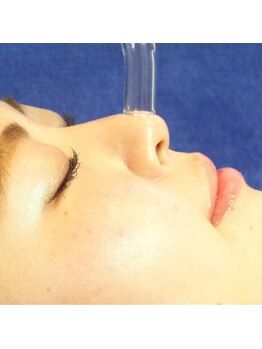 セレブヒルズ 札幌本店(Celeb Hill's)/毛穴吸引