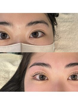 オムズアイ(om's eye.)/上下ラッシュリフト+HBL