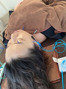 ハリファ鍼灸院 横浜関内院(HariFa鍼灸院)/美容施術