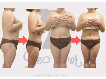 ビーフォー(be for)/ずっとぽっちゃりから卒業♪