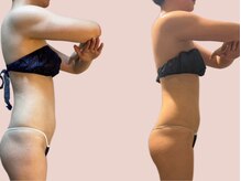 シェリートーキョー 成田店(Cherie Tokyo)/Before＆After /成田店