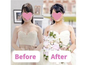 ボディキュア ブライダル美容整体 大阪梅田/フェイスラインすっきり◎/大阪