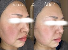 アイシス(AIsis)/【くすみ/ツヤ】LDMプラチナ