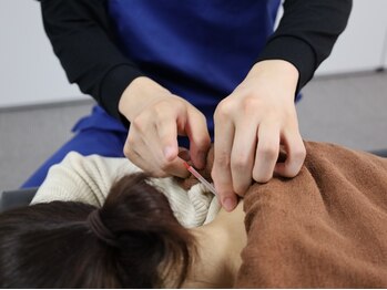小林整骨院 上本町の写真/【鍼灸施術】心と体を整える、本格鍼灸で不調改善