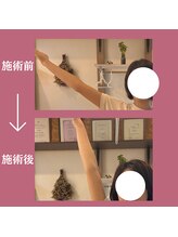 ラシー(la she)/20代後半☆腕があげにくい