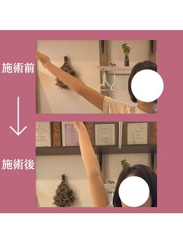 ラシー(la she)/20代後半☆腕があげにくい