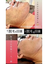 サロンドスパ(Salon de Spa)/ビフォーアフター