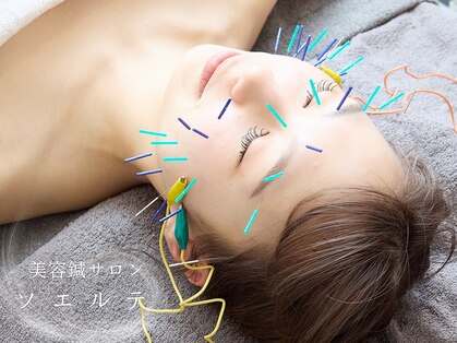 ソエルテの写真