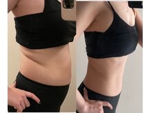 ヨサパーク メル(YOSA PARK mer)の雰囲気（浮腫をとり、数字よりも見た目痩せ！）