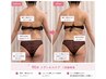 【メディセル美療】むくみ足or背中引き締め体験!【初回限定1,980円】