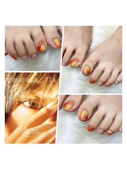 ウィン(Wynn)/山本彩ちゃん