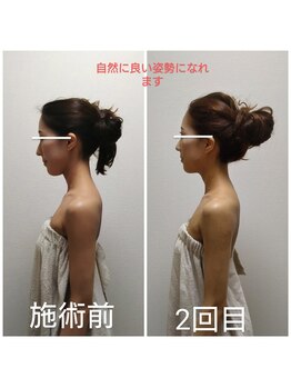 キュアボディ(Cure Body)/美容整体ビフォーアフター/小顔