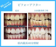 ホワイトニングショップ 甲府店