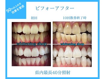 ホワイトニングショップ 甲府店