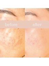 ハナワビューティーサロン(HanaWa beauty salon)/before&after