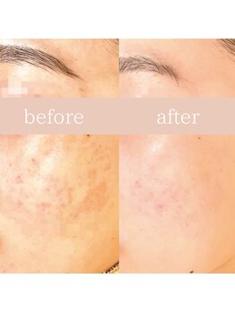 ハナワビューティーサロン(HanaWa beauty salon)/before&after