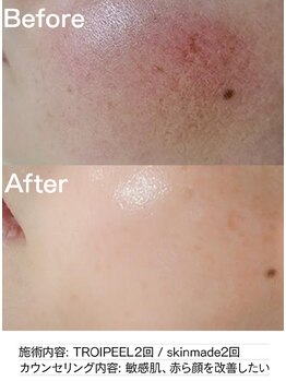 サロン ド セイ(Salon de SEI)/トロイピール