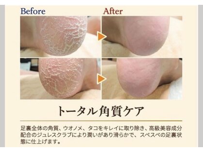 巻き爪補正店 鹿児島店の写真