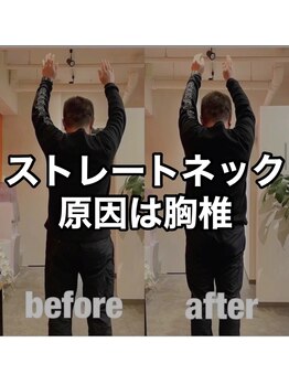 カワル整体 上通り院/ストレートネックの正体は...