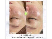 フレア(FULEA)/ラミネーションピール