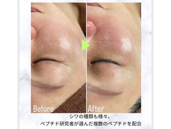 フレア(FULEA)/ラミネーションピール