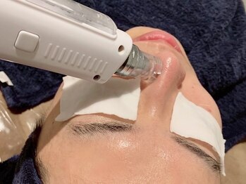 ビーアンドアイ NAGOYA店(B&I)の写真/【毛穴の黒ずみ/ニキビ】一人一人の肌トラブルに徹底アプローチ！結果重視の本格肌改善★清潔感&好感度UP◎