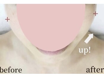 ガーデン(Garden)/滋賀彦根/たるみ改善専門Garden