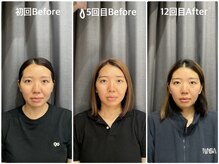 はぐみの杜整骨院 本院/【憧れの小顔へ】本格小顔整体