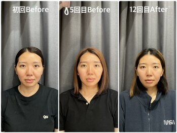 はぐみの杜整骨院 本院/【憧れの小顔へ】本格小顔整体