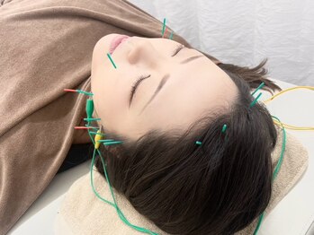 いおり鍼灸接骨院の写真/【半個室×女性鍼灸師】初回￥4400★マッサージでは届かない深層へ直接届く美容鍼灸！根本改善も小顔も◎