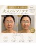 【Wリフト】マシン2台！たるみ＆輪郭とにかく引き上げたい方はこちら22000円