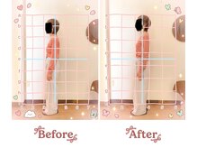 トータルボディケア 整体院ハルヨシ(Total Body Care)/姿勢改善
