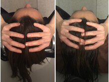 カーサ(ca-sa)/大人気！脳美容ドライヘッドスパ