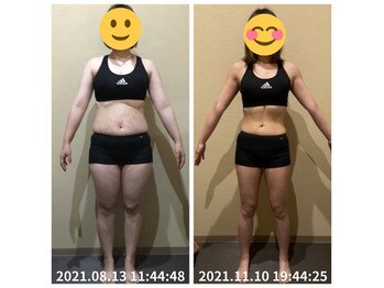 美容整体院元 光の森店/3ヵ月コース before&after