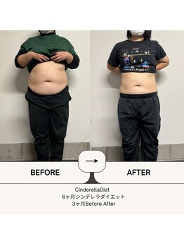 オーシャン整骨院(OCEAN整骨院)/６ヶ月コース