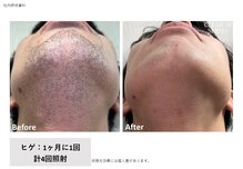 ゲナシー(Genacy)