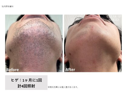 ゲナシー(Genacy)の写真