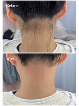 ホワイトワックス 京都四条烏丸(WHITE WAX)/うなじワックス