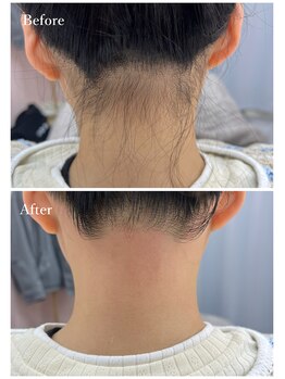 ホワイトワックス 京都四条烏丸(WHITE WAX)/うなじワックス