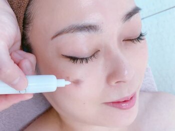 リーフの写真/素肌美人を目指すあなたに！長年のお肌のお悩みは当店の「次世代シミケア」におまかせ♪
