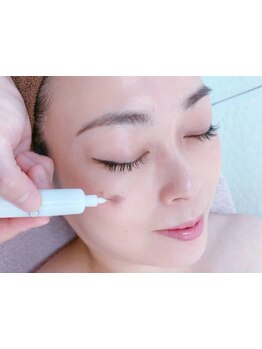 シミしわ改善！予防ケア