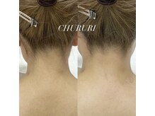 チュルリ 新町店(Chururi)/うなじ/ワックス脱毛/脱毛