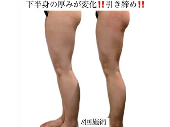痩身革命 大宮店/ダイエットリンパマッサージ