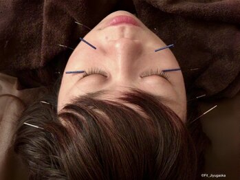 フィットジユウガオカ(Fit_Jiyugaoka)の写真/【顔・体のエイジングケアに美容鍼と注目のインディバ併用】相乗効果で30～50代のお悩み改善にぴったり◎