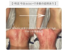 エクラ(eclat)
