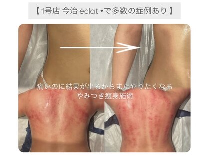エクラ(eclat)の写真