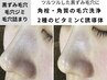 【毛穴洗浄×超ホワイトニング】水素ピーリング&2種のビタミンC誘導体マスク