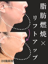 ノーブルノアール(Noble noir)/顔幅ほっそり効果