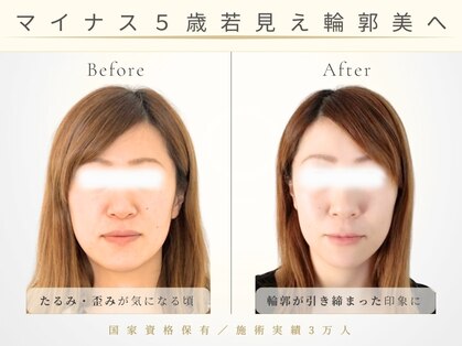 アロハ(ALOHA.)の写真
